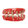 Denture de vieillard